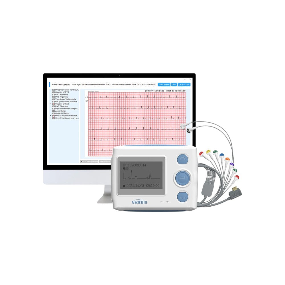 12-Lead AI Holter ECG Monitor — AI analysis detects 17 abnormal heart event types