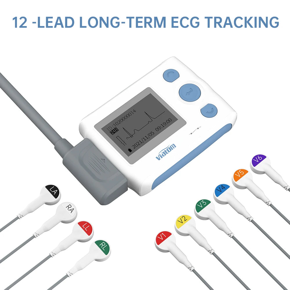 12-Lead AI Holter ECG Monitor — AI analysis detects 17 abnormal heart event types