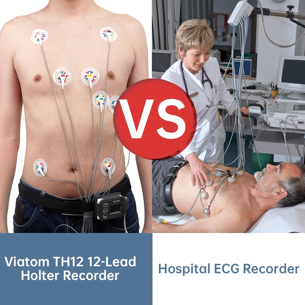 12-Lead AI Holter ECG Monitor — AI analysis detects 17 abnormal heart event types