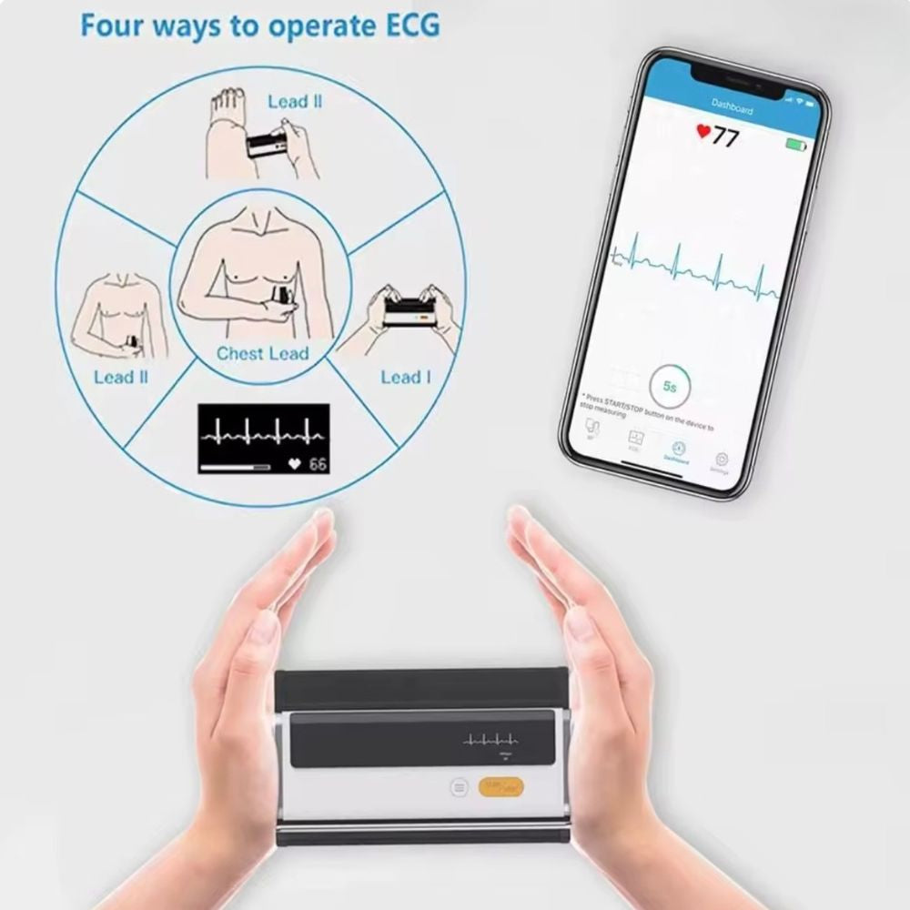 Bluetooth Upper Arm Blood Pressure Monitor with ECG & Heart Rate Monitoring