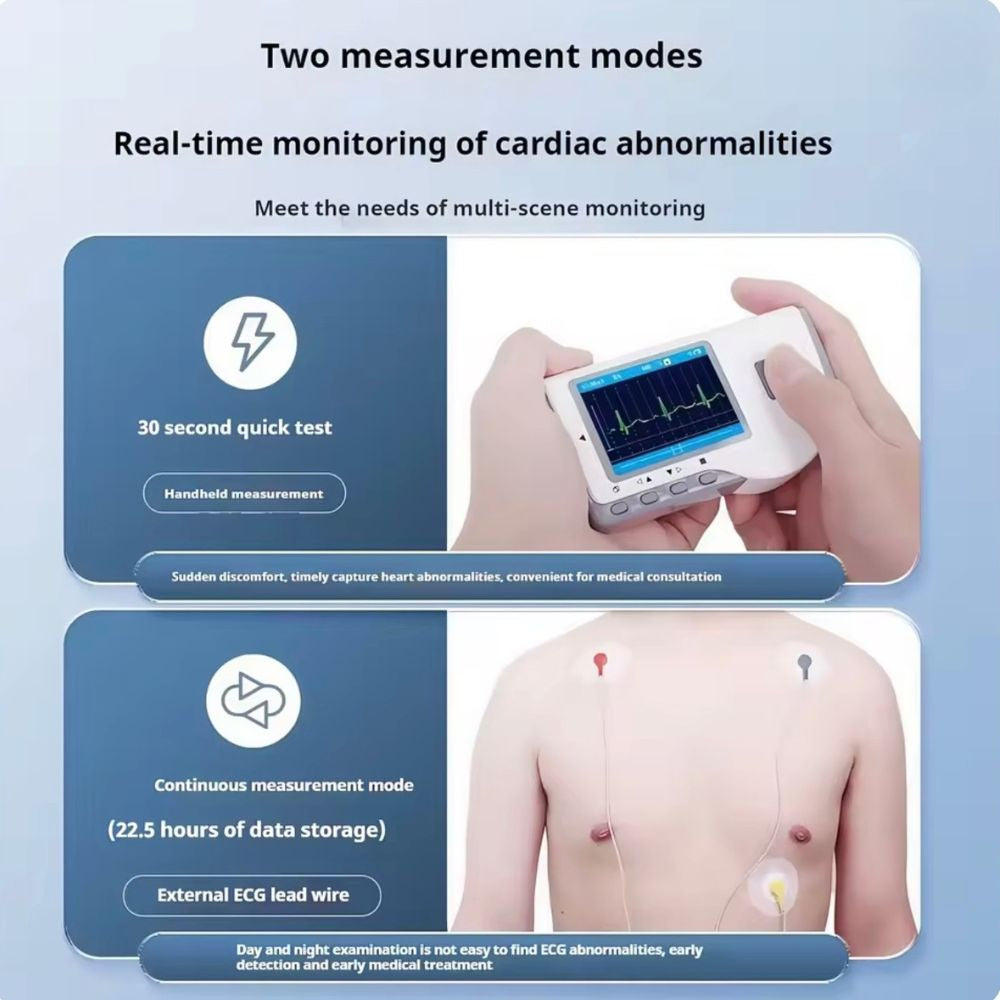 Bluetooth Portable ECG Heart Monitor – Handheld Electrocardiogram (EKG) Recorder with App & Data Storage