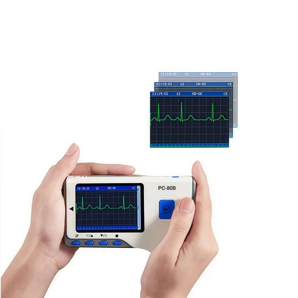 Bluetooth Portable ECG Heart Monitor – Handheld Electrocardiogram (EKG) Recorder with App & Data Storage