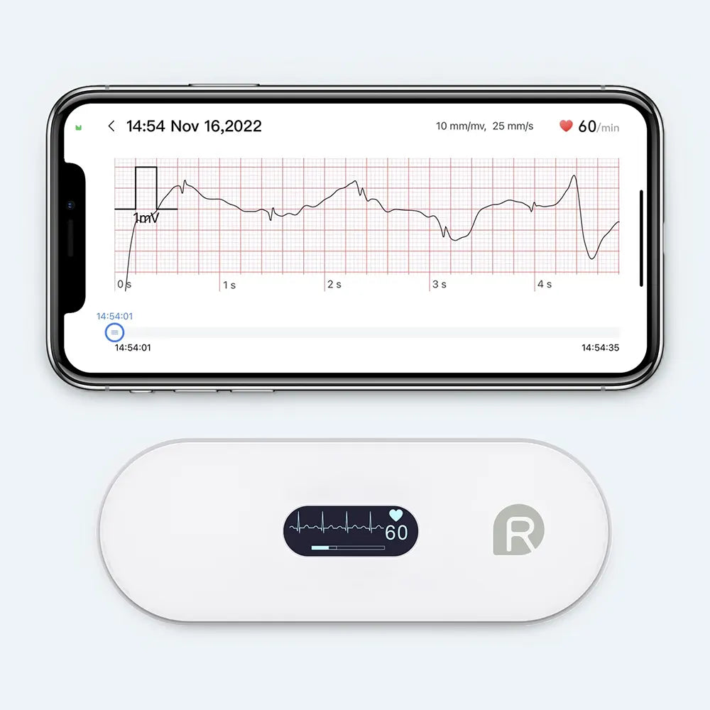 Dynamic ECG (Holter-Style)